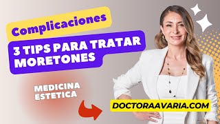 3 Tips para Tratar Moretones por un Tratamiento de Medicina Estética [upl. by Nadeau]