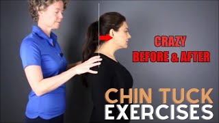 Chin Tuck Exercise  Before and After text neck [upl. by Alle]