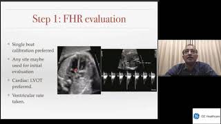 GE Webinar An approach to diagnosis and management of Fetal Arrhythmia Dr Balu Vaidyanathan [upl. by Aay]