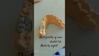 Max dental lab white metal [upl. by Aihseym65]