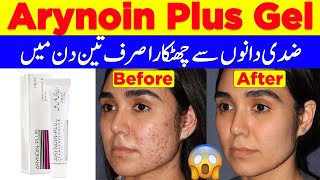 Arynoin Plus Gel 10g  Tretinoin Cream Treatment Of Cystic AcneSkin Care Glowing CreamAcne Cream [upl. by Benton]