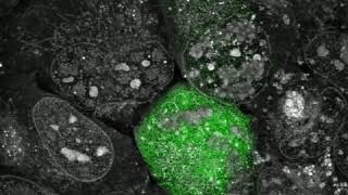 Adenovirus infection in osteosarcoma cells under Nanolives 3D Cell ExplorerFluo [upl. by Inavoj742]