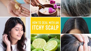 Itchy Scalp Treatments  Remedies For Dandruff Lice and Scalp Acne [upl. by Aneloj]