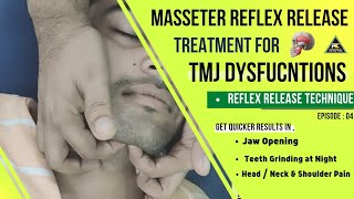 TMJ DISORDER TREATMENT BY REFLEX RELEASE TECHNIQUE HELPFUL IN MOUTH OPENING BRUXISM HEADNECK PAIN [upl. by Vani326]