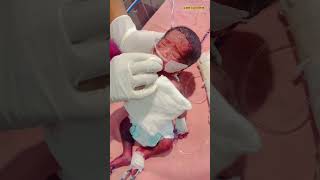 After Birth Newborn Baby immediate carenewbornbabybabybornnewbornmedical [upl. by Nerra]