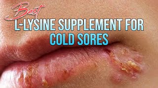 The Best 03 LLysine Supplements For Cold Sores Treatment uses and More [upl. by Aicyle]