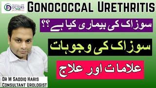 Gonorrhea Gonorrhea Treatment  Gonorrhea Meaning  SOZAK  سوزاک کیا ہے؟  سوزاک کا علاج [upl. by Ecinaj]