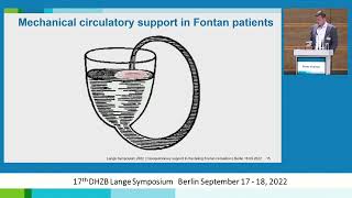 30 Cavopulmonary support to the failing Fontan circulation Kramer [upl. by Jarietta]