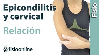 Epicondilitis y su relación con la zona cervical o vértebras cervicales [upl. by Matthaus]