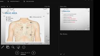 Episode 08 Clinical Examination of the patient with Aortic Stenosis [upl. by Fondea]