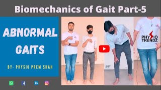 Antalgic gait Hemiplegic gait All Abnormal Gait Demonstration Gait biomechanics [upl. by Arny]