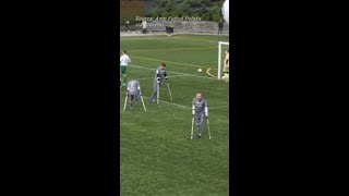 Polish Amputee Soccer Player Scores Stunning Overhead Goal [upl. by Aicek]