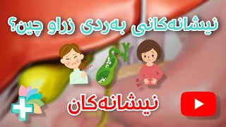 نیشانەکانی بەردی زراو چین؟  نیشانەکان [upl. by Pennebaker330]