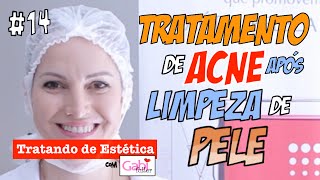 Videoaula Completa Como Fazer Tratamento de Pele após uma Limpeza de Pele com Acne Gabi Tuller [upl. by Jaymie]