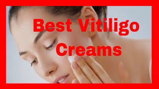 🔥🔥 Best Vitiligo Creams [upl. by Trumaine]