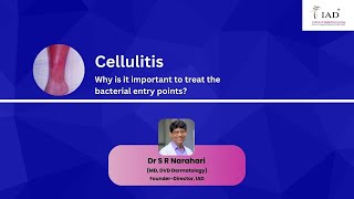 Cellulitis Treatment of bacterial entry points  Dr S R Narahari  Institute of Applied Dermatology [upl. by Kerwon217]