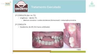 Curso de Odontopediatria planejamento clínico [upl. by Michelsen]