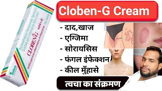 Cloben G Cream  Cloben G Cream Uses in Hindi  त्वचा का संक्रमण  fungal infection [upl. by Ariaj407]