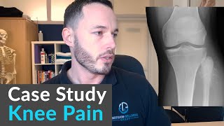 Osteopathic Case Study A Life Changing Diagnosis [upl. by Grearson228]