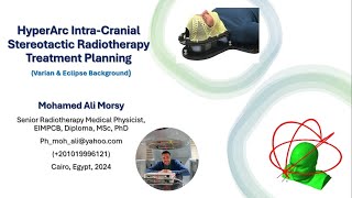 HyperArc Intra Cranial Stereotactic Radiotherapy Treatment Planning [upl. by Llessur531]