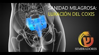 Milagro de sanidad Luxación de coxis [upl. by Balmuth]