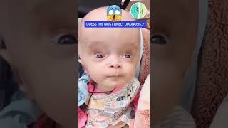 health exam test diagnosis treatment viral vims hydrocephalus pediatrics pediatricians [upl. by Samau833]