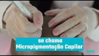 O que é Micropigmentação Capilar [upl. by Imugem309]