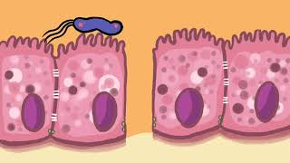 Pathogenesis of Opisthorchis viverrini and Helicobacter pylori coinfection [upl. by Deedahs753]