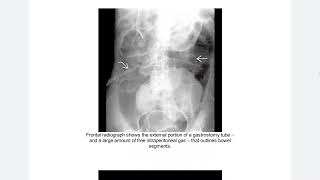 ABDOMEN AND PELVIS EXPERT DDX [upl. by Shaff]