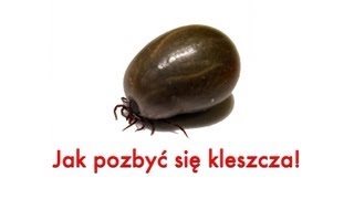 Kleszcz Poradnik jak usunąć kleszcza Wyjmowanie kleszcza [upl. by Akemal697]