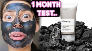 I TESTED THE ORDINARY SALICYLIC ACID 2 CHARCOAL MASK FOR 1 MONTH FOR MY ACNE  This is my skin now [upl. by Orest587]