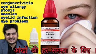 Euphrasia officinalis Homeopathic medicine for eye problems  sign amp Symptoms dosage [upl. by Ahsikahs]