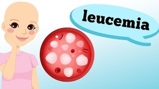 LEUCEMIA O QUE É O QUE OCORRE [upl. by Artened]