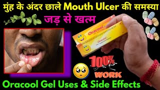 Oracool gel  Oracool gel kaise use kare  Oracool gel uses in hindi  Mouth ulcer treatment [upl. by Ahsilet]