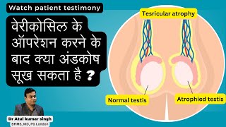 वेरीकोसिल के ऑपरेशन करने के बाद क्या अंडकोष सूख सकता है [upl. by Acissaj]