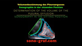 Sonographie  Volumenbestimmung des Pleuraergusses [upl. by Anifur541]