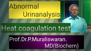 Heat Coagulation Test  Muralis Simplified Biochemistry [upl. by Nino]