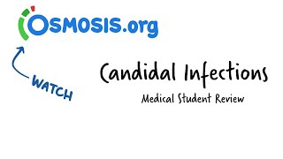 Candidal Infections Osmosis Study Video [upl. by Ylrac]