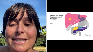 Introduction I am going to beat my inoperable Stage 4 metastatic pancreatic cancer [upl. by Oballa496]