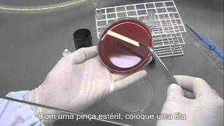 STREPTOCOCCUS AGALACTIAE  Kit para realização da prova do CAMP Test [upl. by Ronyar]