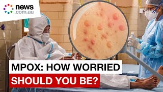 Mpox outbreak how worried should you be [upl. by Ycat]