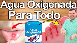 Agua Oxigenada Para Todo  Cómo Usarla  Para Qué Sirve  Beneficios Para Tu Salud Y Belleza [upl. by Osswald594]