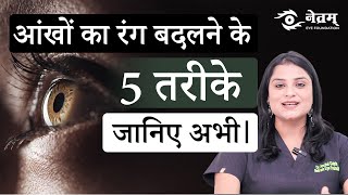 Ways to Change Eye Color  आंखों का रंग बदलने के 5 तरीके  Dr Anchal Gupta  Netram Eye Centre [upl. by Nessi41]