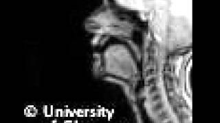 MRI voiceless alveolar fricative [upl. by Ahtoelc692]