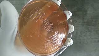 Vibrio cholerae colony morphology on Macconkey agar Demonstration [upl. by Atlee]