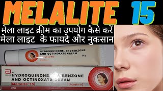 melalite cream use in hindi मेला लाइट क्रीम का उपयोग कैसे करें how to use melalite 15 side amp effects [upl. by Lindly]