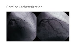 Cardiac Catheterization [upl. by Isawk855]