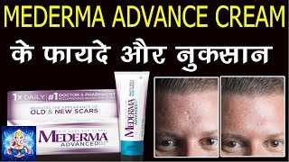 MEDERMA CREAM uses side effects full review in hindi चेहरे के निशान को ख़त्म करने की दवाई [upl. by Asirrom695]