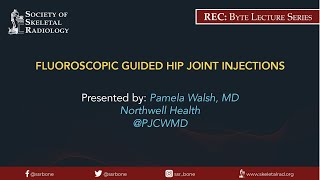 Fluoroscopic Guided Hip Joint Injections [upl. by Gibe]