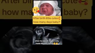 Before birth 20 weeks inside womb ultrasound 🥰🥰viralvideo trending viralshorts [upl. by Domenico]